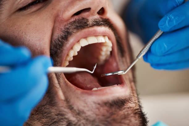 Best Urgent Dental Care  in Los Altos, CA