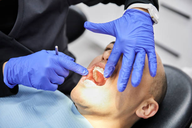 Best Dentist for Tooth Abscess  in Los Altos, CA