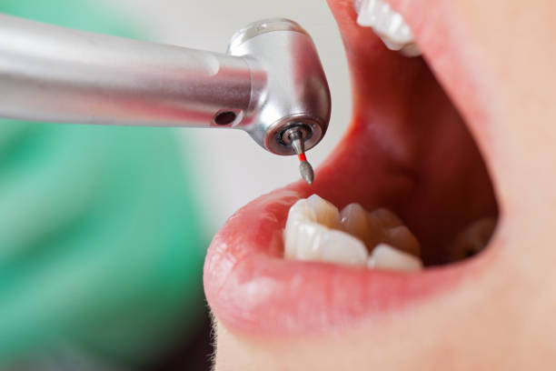 Best Emergency Gum Pain Relief  in Los Altos, CA